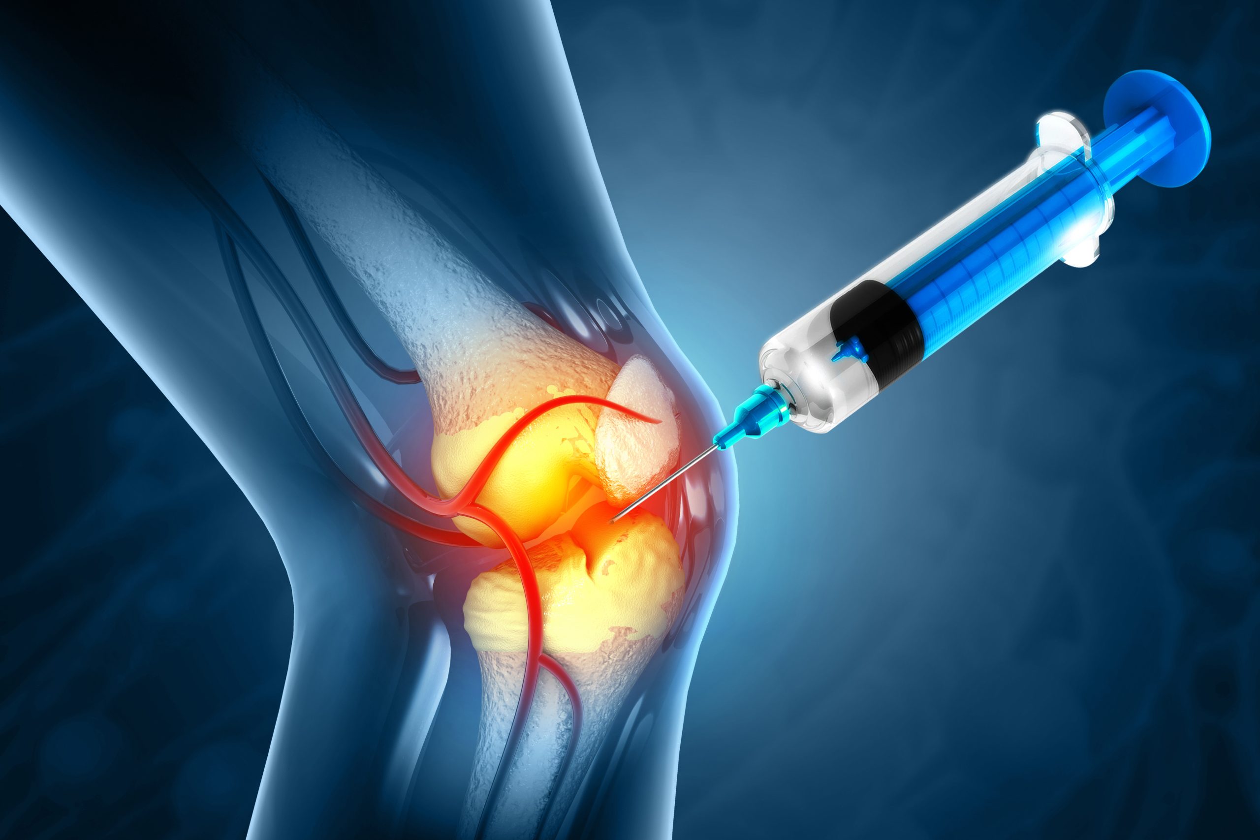 The Power of A2M: A New Frontier in Joint Healing